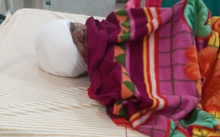 देवरिया में धान मड़ाई के दौरान थ्रेसर से महिला घायल:सिर में गंभीर चोट, गोरखपुर मेडिकल कालेज रेफर