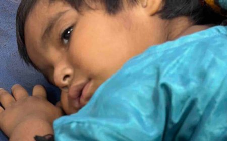 रामपुर में कुत्तों के झुंड ने बच्ची पर किया हमला:दो बच्चों को बनाया निशाना, ग्रामीणों ने की कार्रवाई की मांग