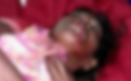 लखीमपुर में जंगली जानवर के हमले से महिला घायल:गंभीर हालत में लखनऊ रेफर, वन विभाग को तेंदुए के पैरों के मिले निशान