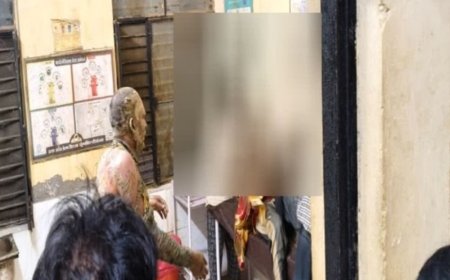 प्रेम-प्रसंग के विवाद में किशोरी और युवक ने आग लगाई:सुल्तानपुर में दोनों झुलसे; सीएचसी से राजकीय मेडिकल कॉलेज रेफर