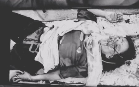 गोरखपुर में पत्नी पर हंसिया से हमला, हालत गंभीर:अवैध संबंध के शक में सिर और गर्दन पर किया वार, पति गिरफ्तार