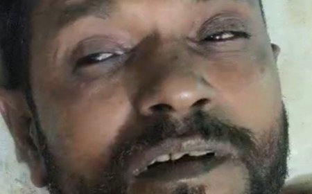 जौनपुर में किसान ने खुद को आग लगाई:जमीन पर रास्ता बनाने को लेकर विवाद, पुलिस पर लगाए आरोप; पुलिस बोली- रुकवा दिया था निर्माण