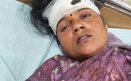 फिरोजाबाद में बात न करने पर फोड़ा महिला का सिर:SP कार्यालय में 3 के खिलाफ की शिकायत, जबरदस्ती बात करने के लिए बनाते हैं दबाव