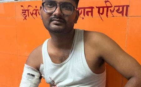 लखनऊ फास्ट फूड खा रहा युवक अचानक हुआ घायल:गोली और पटाखे में उलझी पुलिस, ट्रामा सेंटर रेफर
