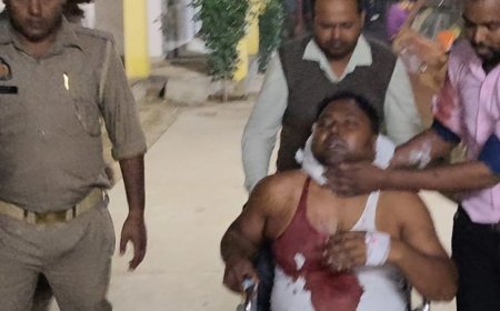 वाराणसी में डॉक्टर के भाई पर जानलेवा हमला:धारदार हथियार से गर्दन पर वार, 15 टांके लगे; आधी रात कमरे में घुसे दो लोग