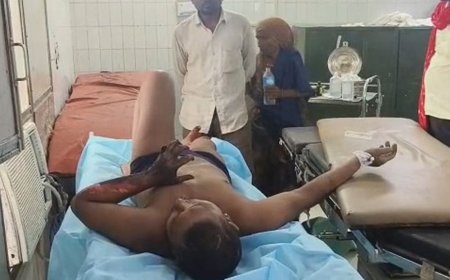 महोबा में जलते चूल्हे में गिरकर युवक झुलसा:घर से भागकर नाले में कूदा, हालत गंभीर होने पर हायर सेंटर रेफर