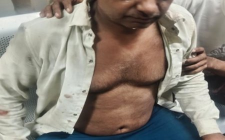 शाहजहांपुर में खंभे पर केबल बांधने को लेकर विवाद, फायरिंग:दोनों पक्षों के 11 लोग घायल, कई को लगे छर्रे