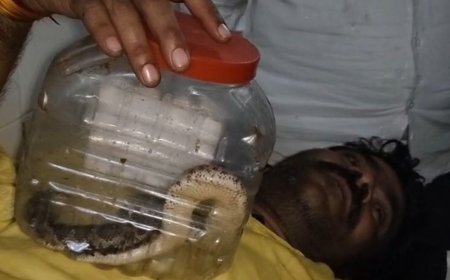 बांदा में सांप काटने पर सांप लेकर अस्पताल पहुंचा युवक:शराब के नशे में बोला, डिब्बे में बंद इसी सांप ने मुझे कांटा