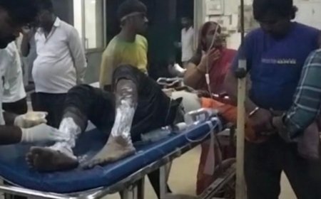 मूर्ति विसर्जन के लिए जाते समय जनरेटर में आग लगी:सुल्तानपुर में 16 साल का किशोर झुलसा, मेडिकल कॉलेज में इलाज जारी