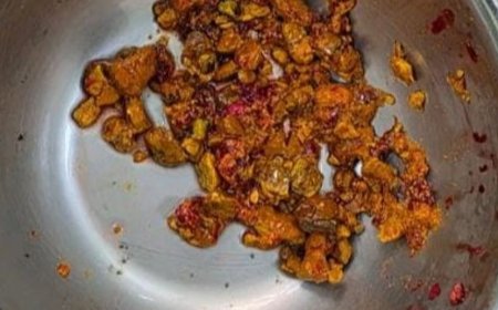पित्त की नली से निकले 70 पत्थर:29 साल से पथरी से परेशान था युवक, मेडिकल कालेज में हुआ आपरेशन