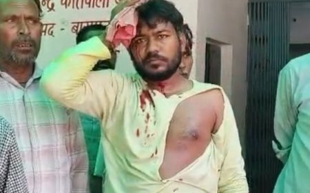 बागपत में नगरपालिका कर्मचारी पर लोहे के पाइप से हमला:सिर में गंभीर चोट, पुलिस ने 4 लोगों पर केस दर्ज कर तलाश शुरू की