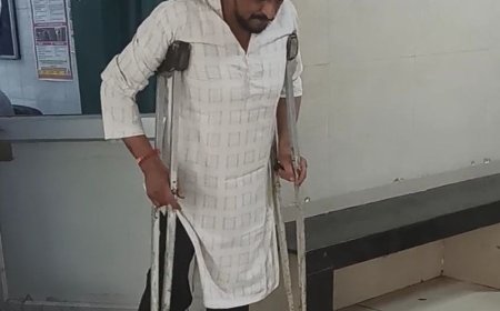 कानपुर में दिव्यांग प्रॉपर्टी डीलर पर कुत्तों का हमला:स्कूटी पर चढ़कर पैर में काटा, बैसाखी से भगाकर बचाई जान