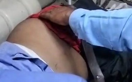 कुशीनगर में ट्रेन की चपेट में आकर दोनों पैर कटे:पुलिस बोली- शराब के नशे में रेलवे ट्रैक पर घूम रहा था लैब संचालक, हालत गंभीर
