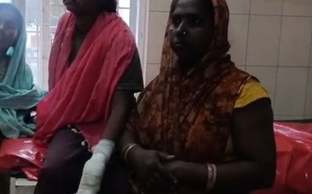 प्लास्टिक गोदाम में काम करते समय युवती का कटा हाथ:उन्नाव में प्लास्टिक काटते समय मशीन की चपेट में आई युवती, हालत गंभीर