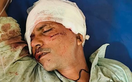 कानपुर में ट्रक की टक्कर से एक की मौत:गंभीर हालत में दूसरा जिला अस्पताल रेफर, परिजनों में शोक का माहौल