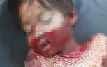 फतेहपुर में स्कूल बस ने बच्ची को रौंदा, मौत:सड़क किनारे खड़ी थी बच्ची , हादसे के बाद चालक फरार