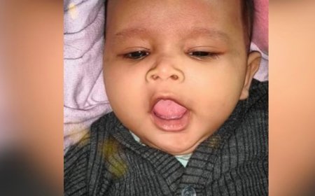कौशांबी में सोफे पर सो रही मासूम की जलकर मौत:चाने में चाचा भी झुलसे, कमरे में लगी आग से जला सामान, शॉर्ट सर्किट की आशंका