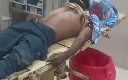 देवरिया में बस ने बाइक को मारी टक्कर:एक युवक की मौत, भतीजा घायल; बाजार से लौटते समय हुआ हादसा