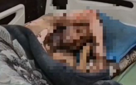 हाथरस में शराब के नशे में युवक ट्रांसफार्मर पर चढ़ा:करंट लगने से गंभीर रूप से झुलसा, स्कूटी की मांग पर मां से झगड़ा