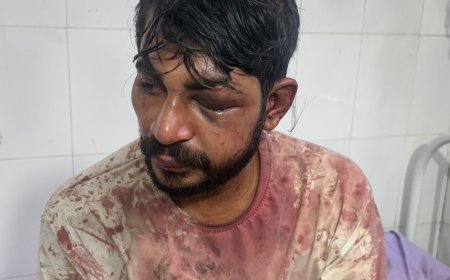 बुलंदशहर में युवक का अपहरण कर आंख फोड़ी:जमीनी विवाद में सिर और पैर कुचले, जंगल में फेंका; गंभीर हालत में भर्ती