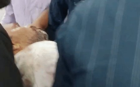 झांसी में कारोबारी पर कुल्हाड़ी से जानलेवा हमला:दुकान पर जाते समय दबंगों ने घेरकर पीटा, हाथ-पैर तोड़े, 14 पर केस