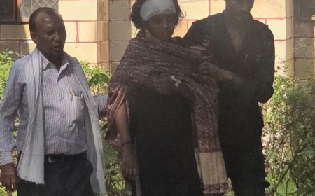 मारपीट में सिर की हड्डी टूटी, युवती एसपी ऑफिस पहुंची:पुलिस पर हल्की धाराओं में FIR दर्ज करने और थाना प्रभारी पर मिलीभगत का आरोप