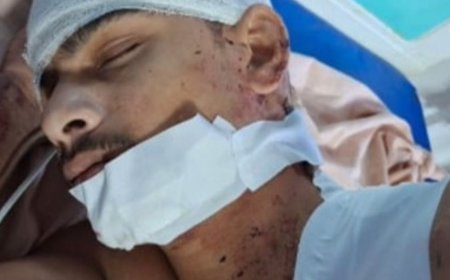 मुरादाबाद में युवक पर चाकू से जानलेवा हमला:स्कूटी और बाइक में टक्कर के बाद दोनों पक्षों में हुई थी कहासुनी