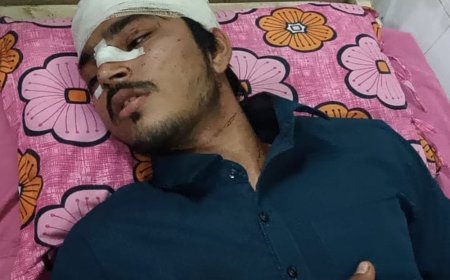 नमाज पढ़कर लौट रहे युवक पर धारदार हथियारों से हमला:8 महीने पुरानी रंजिश में वारदात, परिवार ने जताया जान का खतरा