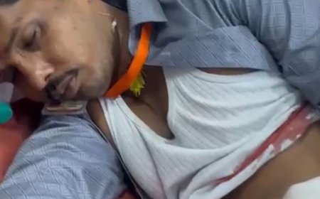जौनपुर में विसर्जन के दौरान चाकूबाजी, युवक घायल:पेट में फंसा चाकू, गंभीर हालत में वाराणसी हुआ रेफर