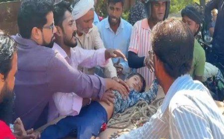 करंट की चपेट में आया मासूम:मथुरा वृंदावन रोड पर हुआ हादसा, गंभीर रूप से हुआ जख्मी