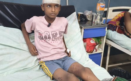 संभल में आवारा कुत्तों का आतंक, तीन बच्चों पर हमला:एक के सिर से मांस नोचा, 9 टांके लगे, तीन घायल