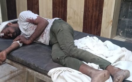 डंपर ने बाइक सवार दो युवकों को टक्कर मारी:एक की हालत नाजुक, ट्रॉमा सेंटर रेफर; दूसरे का सीएचसी में इलाज जारी