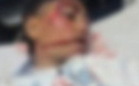 अमरोहा में अज्ञात वाहन की टक्कर से युवक की मौत:दो दोस्त गंभीर घायल, शादी समारोह में भात देकर लौट रहे थे
