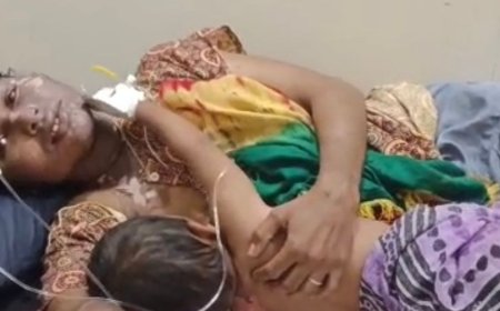 महराजगंज में झगड़े में खौलता तेल फेंका, मां-बेटी झुलसीं:कोटवा पिपरिया गांव में देवरानी-जेठानी के बीच विवाद; जिला अस्पताल में भर्ती