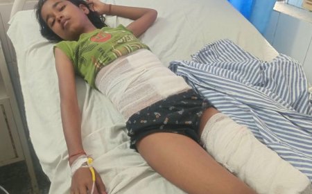 सड़क हादसे में परिवार के 10 लोग घायल:खीर लेकर मंदिर जा रहे परिवार का पलटा था ई-रिक्शा, पांच बच्चों समेत 10 घायल