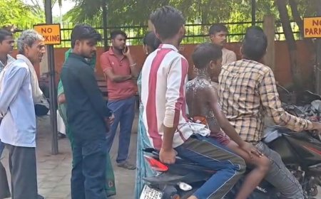 10 साल का बच्चा आग से झुलसा:फिरोजाबाद के बरगदपुर गांव में दुर्गा पूजा के दौरान हुआ हादसा, अस्पताल में भर्ती