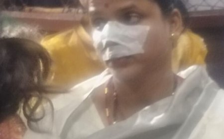 करवा–चौथ की पूजा करती महिला के नाक में लगी गोली:गोरखपुर जिला अस्पताल में भर्ती, डॉक्टर की निगरानी में चल रहा इलाज