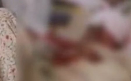 हाथरस में बाल कल्याण समिति अध्यक्ष घायल:कार अनियंत्रित होकर गड्ढे में गिरी, मथुरा से हाथरस आते समय हादसा